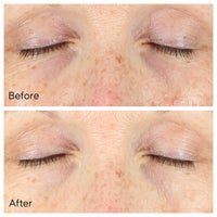 Murad Environmental Shield Vita-C Eyes Dark Circle Correcteur 15ml