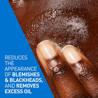 CeraVe Blemish Control Cleanser with 2% Salicylic Acid & Niacinamide for Acne Prone Skin, Controls Acne & Spots, Unclog Pores & Reduces Blemishes, 236ml (Made In France)