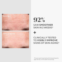 Murad Resurgence Retinol Youth Renewal Serum 30ml