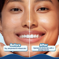 Aqualogica 5 Barrier+ Hydra Gel Moisturizer with 5 Essential Ceramides & Avocado | 24-Hour Intense Hydration | Weightless Water-Like Gel Texture | Non Sticky & Quick Absorbing for Healthy Skin Barrier | 200 g