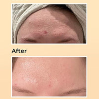 Cosrx Advanced Snail 96 Mucin Power Essence (100 ml)