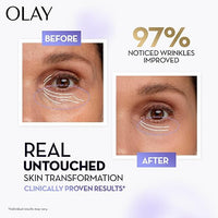 Olay Retinol24 Max Night Serum l Visibly Reduces Fine Lines in 7 Nights | Max Repair, Max Hydration l No Redness or Irritation | Fragrance Free l Normal, Oily, Dry and Combination Skin l 30ml