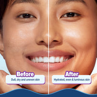 Aqualogica Illuminate + Hydra Gel Moisturizer with Wild Berries & Alpha Arbutin - 200g