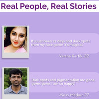 The Derma co 2% Kojic Acid Cream - 30g