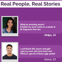 The Derma co 5% Niacinamide Daily Face Serum with Alpha Arbutin & Multivitamin - 30ml