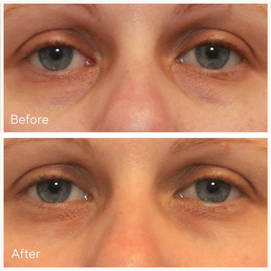 Murad Environmental Shield Vita-C Eyes Dark Circle Correcteur 15ml