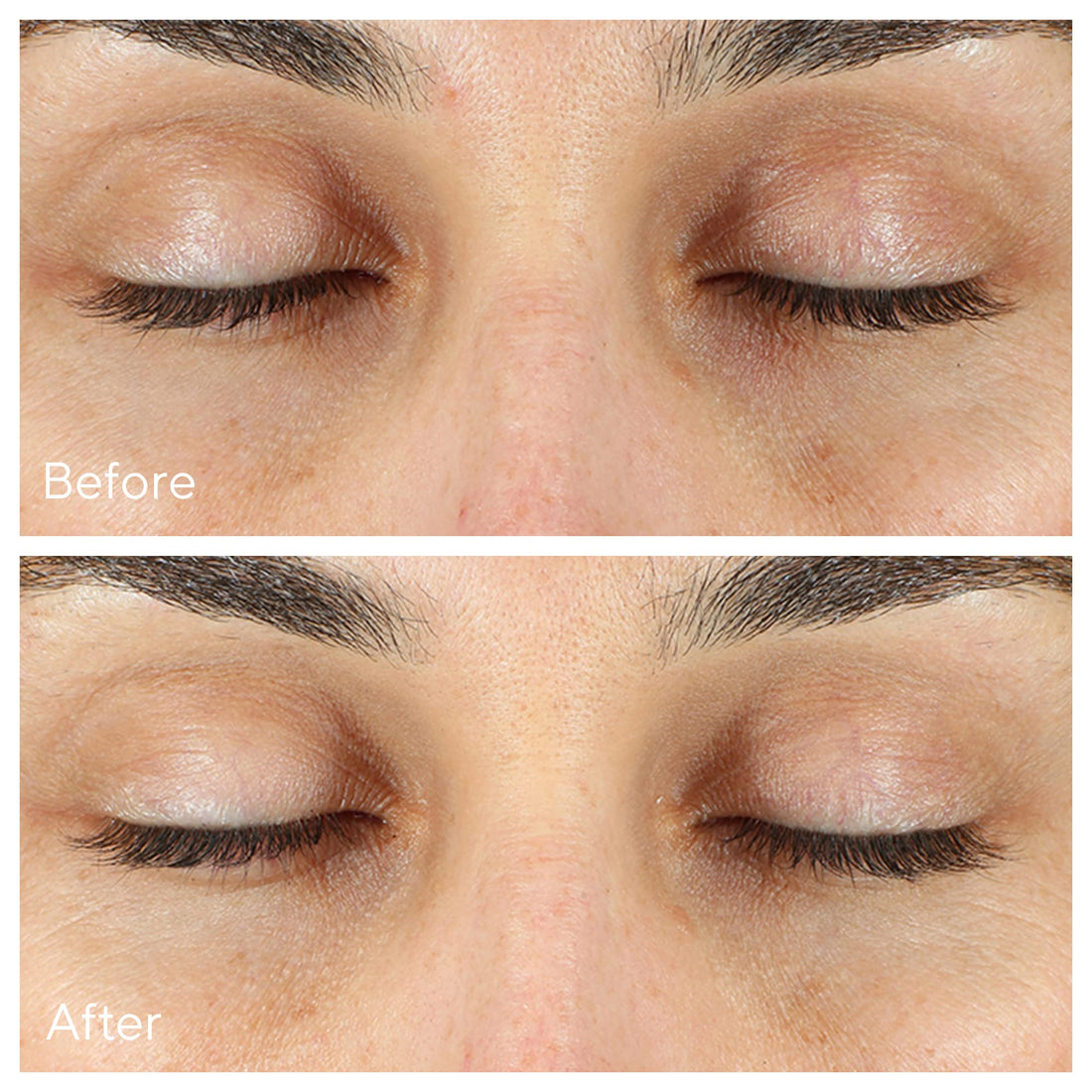 Murad Environmental Shield Vita-C Eyes Dark Circle Correcteur 15ml