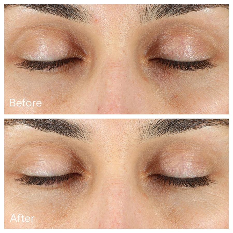 Murad Environmental Shield Vita-C Eyes Dark Circle Correcteur 15ml