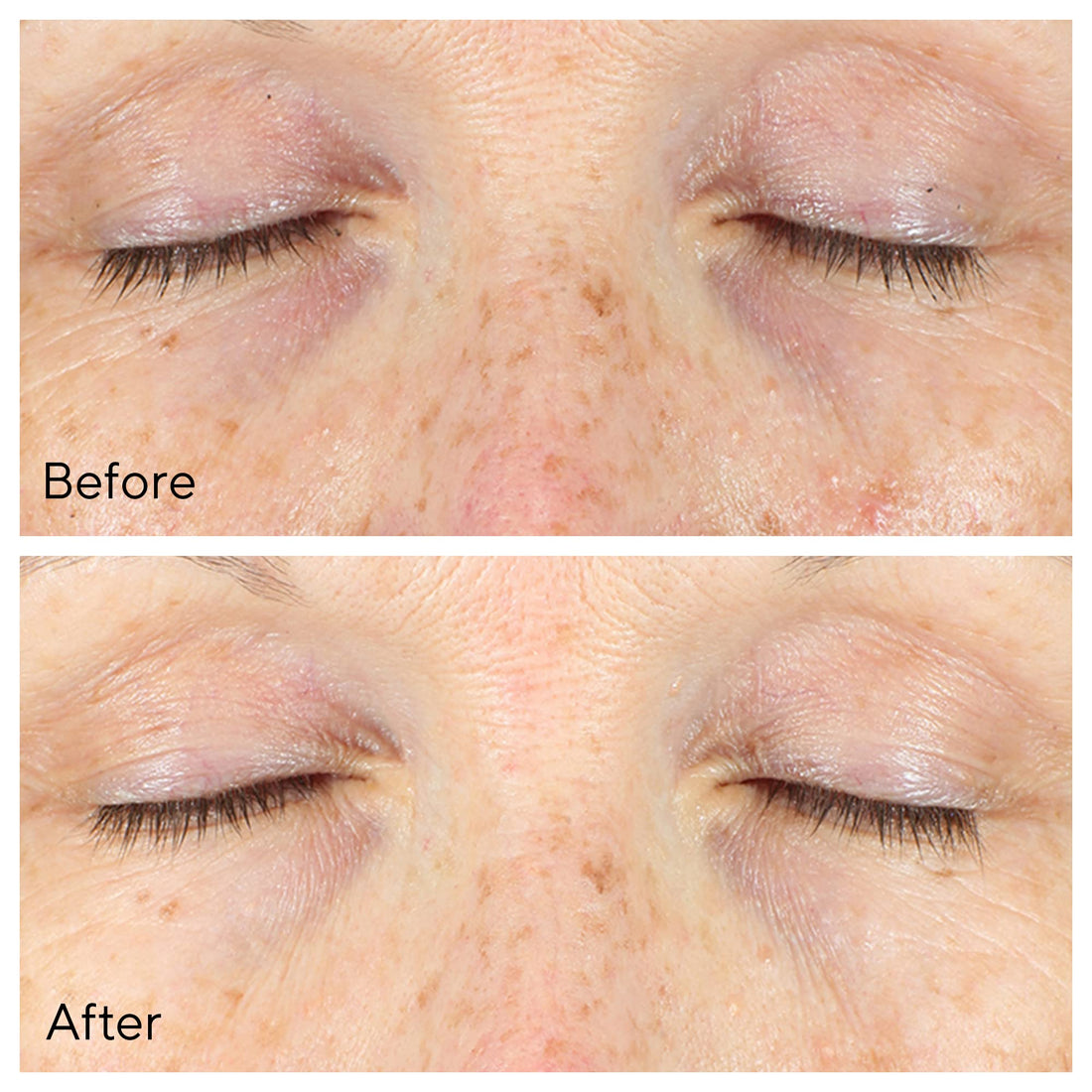 Murad Environmental Shield Vita-C Eyes Dark Circle Correcteur 15ml