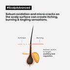 L’Oréal Scalp Advanced AHA 4% Carbonic Acid Shampooing Professional 300ml