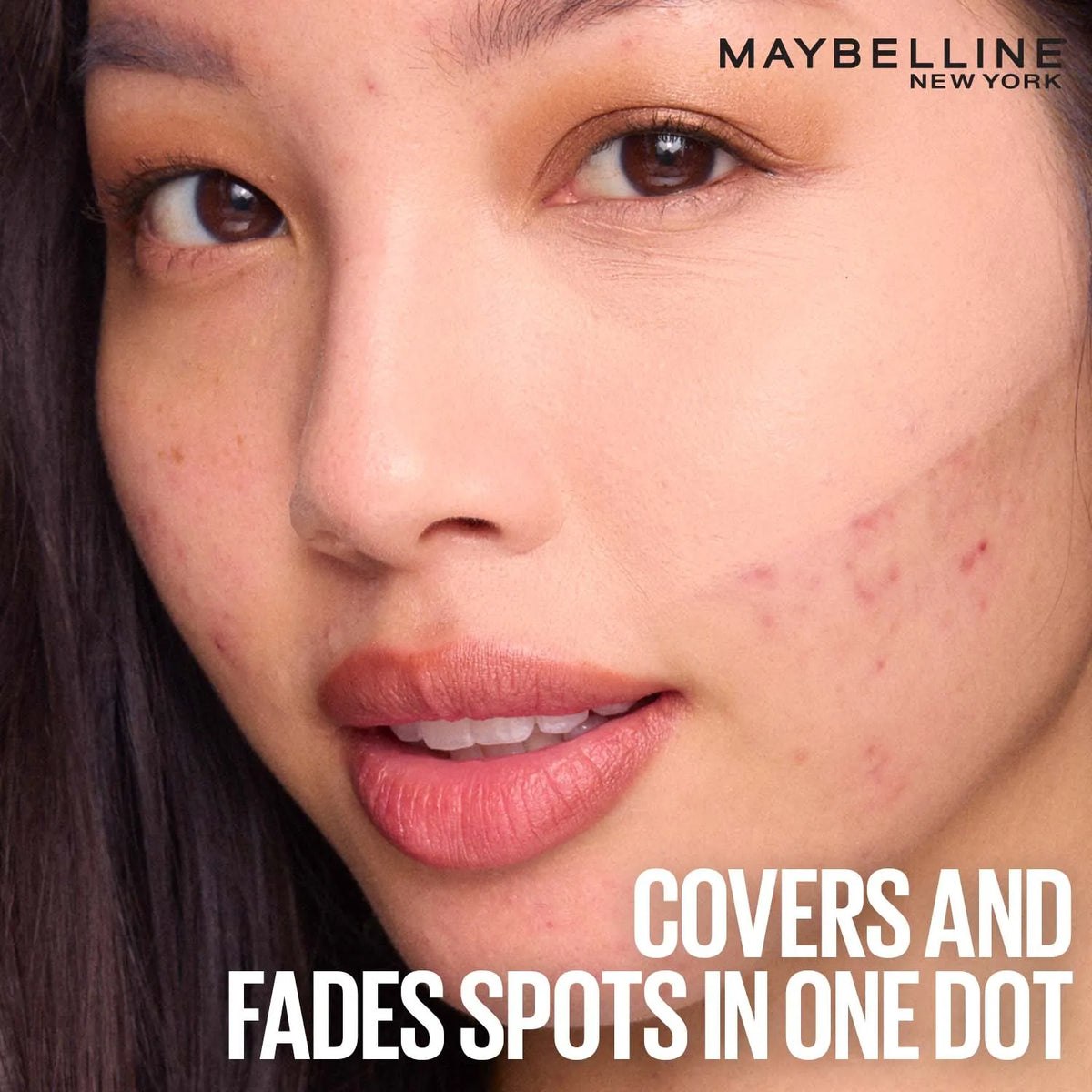 Maybelline New York Fit Me Spot Rescue Full Coverage Concealer, 24H Wear, Fades Spots, Minimizes Pimples, Clinically Tested, Non Comedogenic 15g