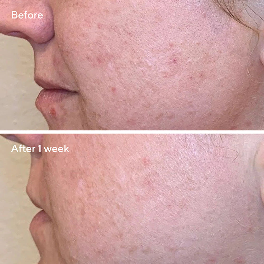 Murad Daily Clarifying Peeling Clarifiant Quotidien AHA/BHA/Retinoid 95ml