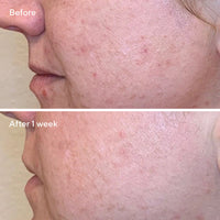 Murad Daily Clarifying Peeling Clarifiant Quotidien AHA/BHA/Retinoid 95ml