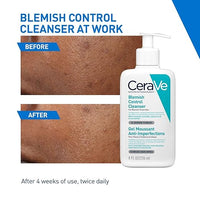 CeraVe Blemish Control Cleanser with 2% Salicylic Acid & Niacinamide for Acne Prone Skin, Controls Acne & Spots, Unclog Pores & Reduces Blemishes, 236ml (Made In France)