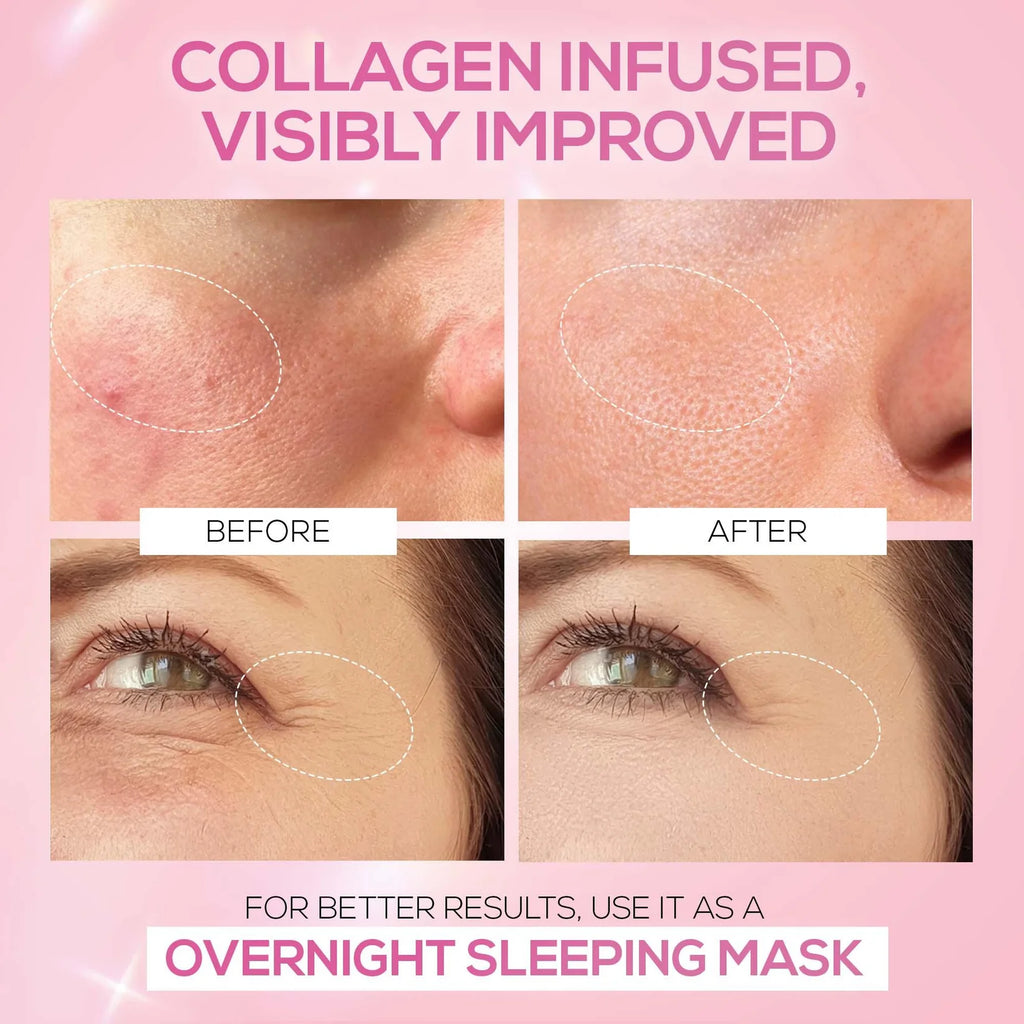 RENEE Pink Therapy Hydrolyzed Collagen Jelly Cream For Anti-Aging & Hydrated Skin 50g