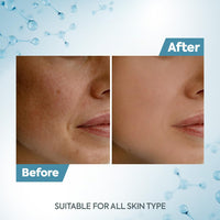 Raaga Professional De-Tan Tan Removal Cream Kojic & Milk 500g