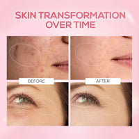 RENEE Pink Therapy PDRN Pink Peptide Serum For Hydrated & Radiant Skin 30ml