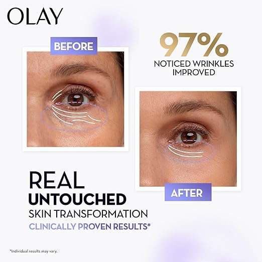 Olay Retinol24 Max Night Serum l Visibly Reduces Fine Lines in 7 Nights | Max Repair, Max Hydration l No Redness or Irritation | Fragrance Free l Normal, Oily, Dry and Combination Skin l 30ml