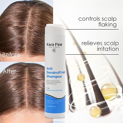 KERA FINE ANTI DANDRUFF HAIR SHAMPOO | 250ML | SAFE FOR SENSITIVE SCALP COOLING MENTHOL REFRESHES DANDRUFF REMOVAL | SULFATE FREE & PARABEN FREE | SODIUM CHLORIDE FREE