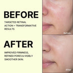 Celimax The Vita-A Retinal Shot Tightening Booster, For Anti-Aging, Dark Spots & Wrinkles (15ml)