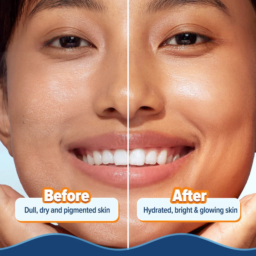Aqualogica Glow+ Hydra Gel Moisturizer with Vitamin C & Papaya 200g