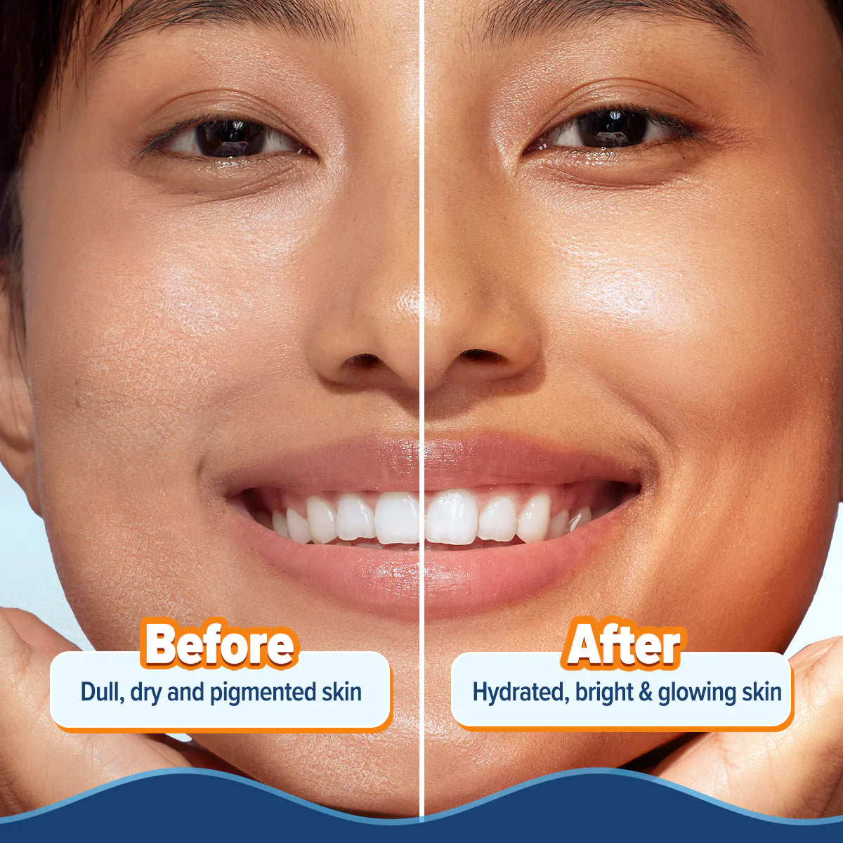 Aqualogica Glow+ Hydra Gel Moisturizer with Vitamin C & Papaya 200g