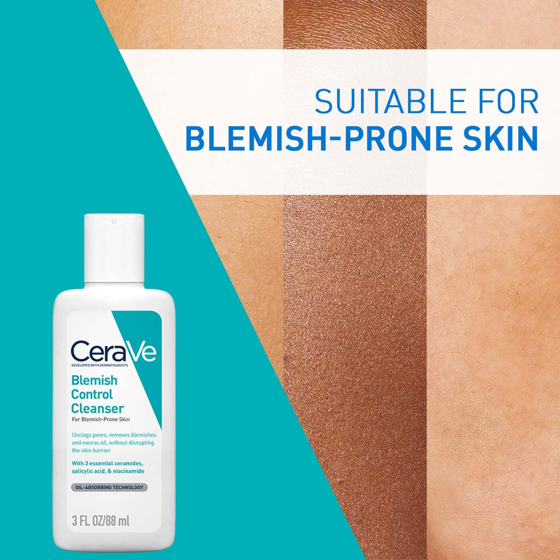 CeraVe Blemish Control Cleanser with 2% Salicylic Acid & Niacinamide for Acne Prone Skin, Controls Acne & Spots, Unclog Pores & Reduces Blemishes 88ml