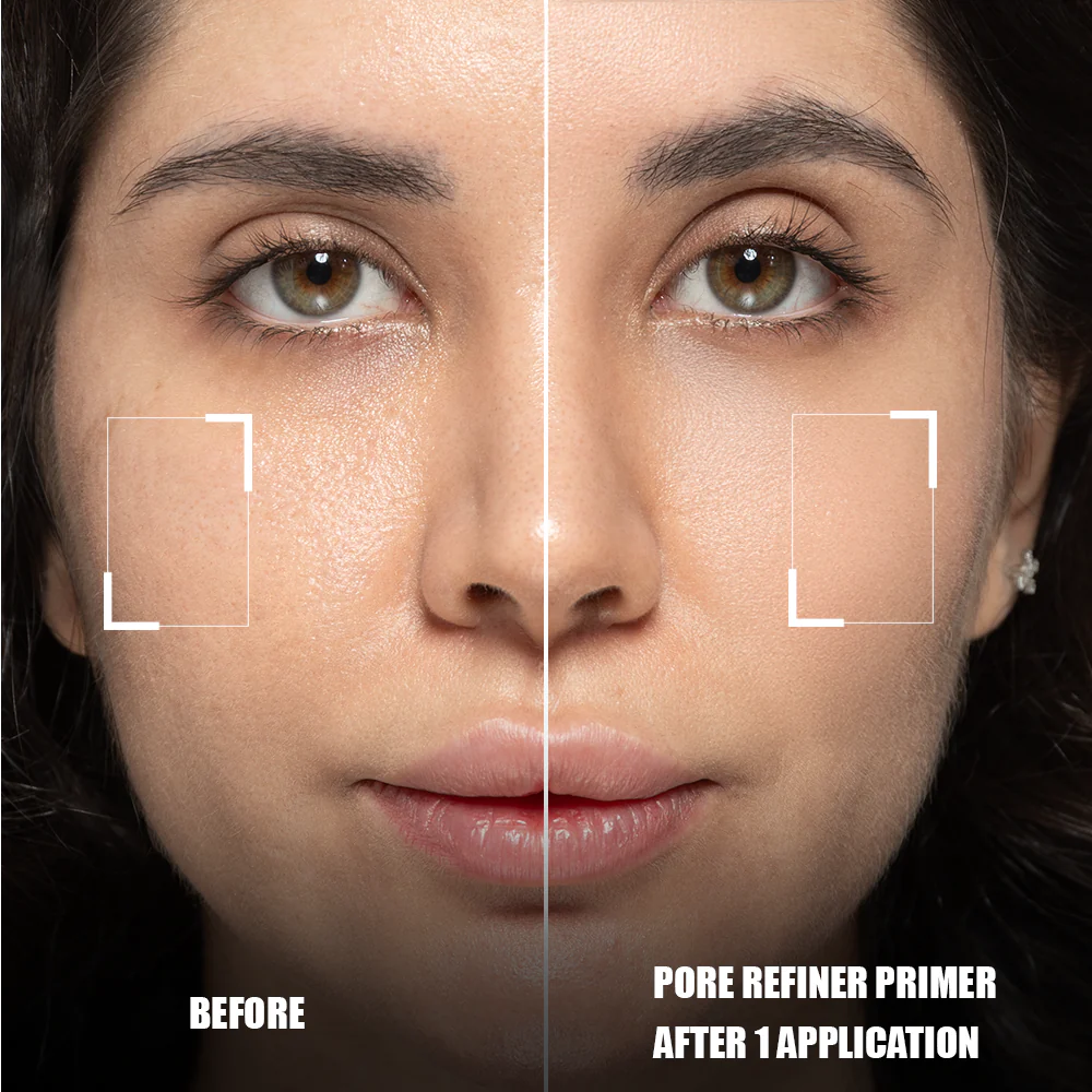 Forever52 Layered Pore Refine LYD001