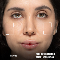 Forever52 Layered Pore Refine LYD001