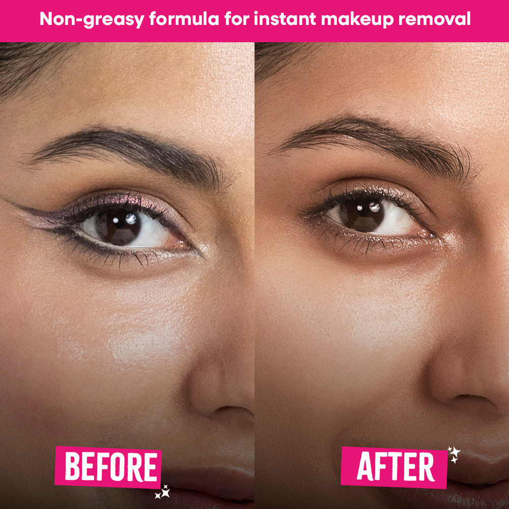 Nykaa Micellar Melter Cleansing Water - Sensitive Skin Gentle Cleanser With Vitamin C & Niacinamide (150ml)